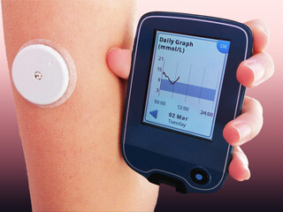 Closeup od device for continuous glucose monitoring in blood – CGM. This device wirelessly...