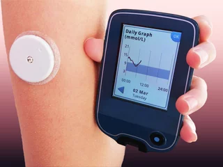 Fotobehang Closeup od device for continuous glucose monitoring in blood – CGM. This device wirelessly continuously reads sensor on skin and monitors glucose level in real time. Diabetes type 1. Insulin depend © Dragoljub