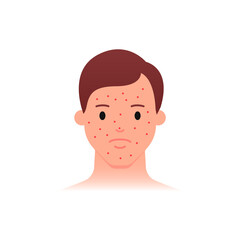 Acne problem icon, male character. Flat style.