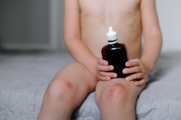 Children injury. Deep scratches on the skin on the kids knee. Wounds, scratches, abrasions on the child leg. Bottle of antiseptic and sponges to clean the wound 