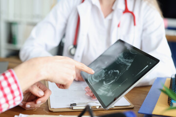 Woman doctor showing digital tablet with ultrasound picture of fetus in clinic closeup