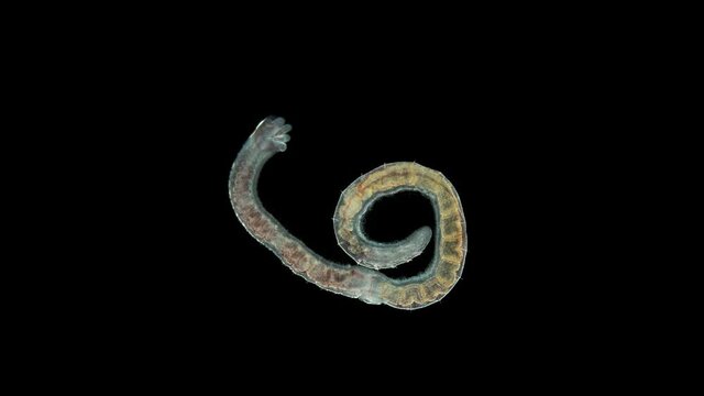 Aulophorus sp worm under a microscope, family Naididae. Life in water contaminated with organic residues. At the end has gills similar to tentacular appendage