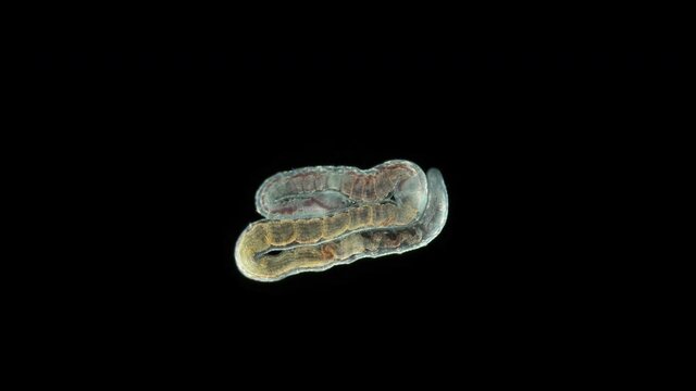 Aulophorus sp worm under a microscope, family Naididae. Life in water contaminated with organic residues. At the end has gills similar to tentacular appendage