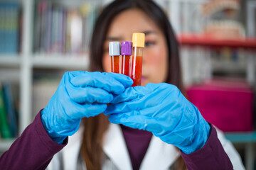 Female asian doctor examining blood sample from the tube. 
