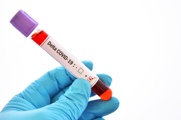 Fototapeta premium Delta variant COVID-19 positive, blood sample tube positive with delta variant or Indian strain COVID-19