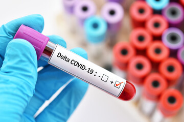 Obraz premium Delta variant COVID-19 positive, blood sample tube positive with delta variant or Indian strain COVID-19