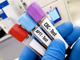 Scientist holding  test tube with sample for CBC and APTT test sample closed view, laboratory...