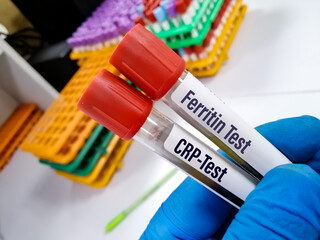 Test tube with blood sample for ferritin and CRP test