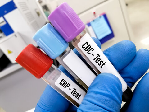 Scientist holding test tube with sample for CBC and coagulation and CRP test sample, closed view,laboratory backgroud