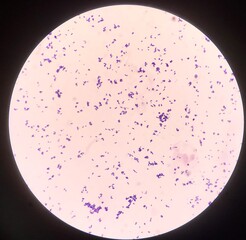 Bacteria cell in Gram stain.