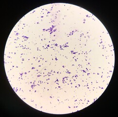 Bacteria cell in Gram stain.