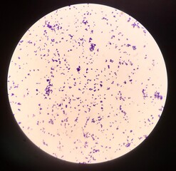Bacteria cell in Gram stain.