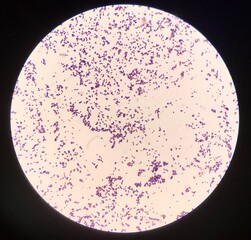 Bacteria cell in Gram stain.