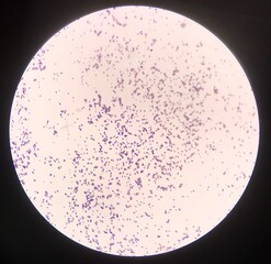 Bacteria cell in Gram stain.