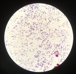 Bacteria cell in Gram stain.
