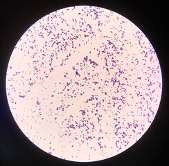 Bacteria cell in Gram stain.