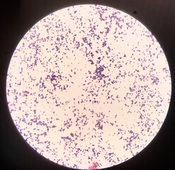 Bacteria cell in Gram stain.