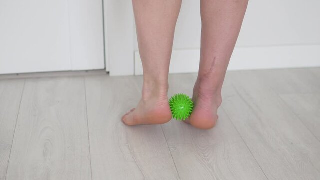 Close-up of the legs, the woman gets up on her socks with a clamped ball. Reabltliteation after stitching of the Achilles tendon.