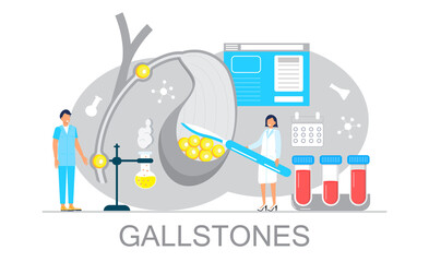 Gallbladder concept vector. Doctors treat gallstones. Web, landing page