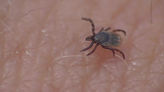 Zecke krabbelt auf menschlicher Haut