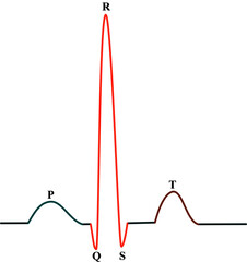 The normal electrocardiography in humans – Heartbeat line