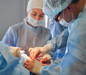 Doctors performing abdominoplasty surgery in clinic. Male plastic surgeon and female assistant conducting abdominal plastic surgery in operating room. Concept of medicine, tummy tuck, cosmetic surgery