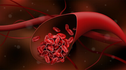 The blood clot stops the flow of red blood cells. 3d vector illustration