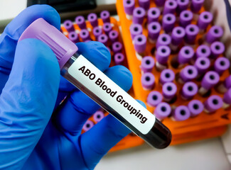 Blood sample for ABO blood grouping.
