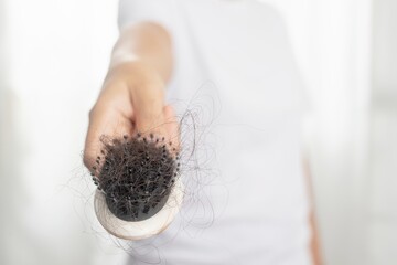 Women are allergic to shampoo causing hair loss and dandruff.