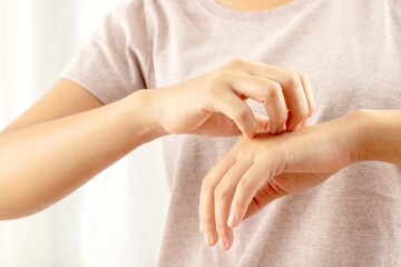 Woman itchy arm due to allergy to skin lotion.