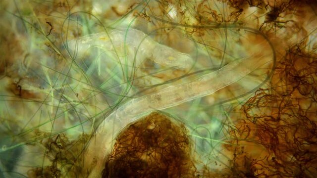 worms Nais sp. and Chaetogaster sp. under a microscope, Tubificidae family, a subclass of Oligochaeta, they are feed on plant foods (algae) and remains of dead organisms, sometimes protozoa