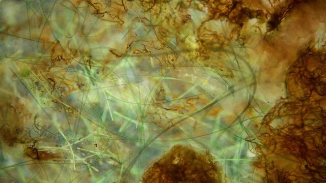 worms Nais sp. and Chaetogaster sp. under a microscope, Tubificidae family, a subclass of Oligochaeta, they are feed on plant foods (algae) and remains of dead organisms, sometimes protozoa