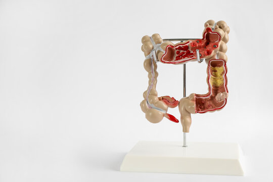 Human Colon Model On Light Background. Space For Text