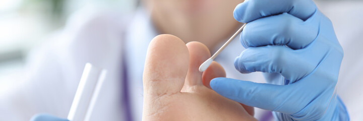 Doctor treating patients toes in clinic closeup