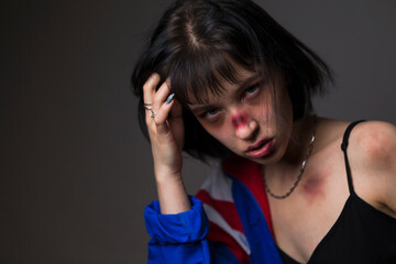 Females Violence Ideas. Caucasian Female Victim of Domestic Family Violence and Abuse With Multiple...