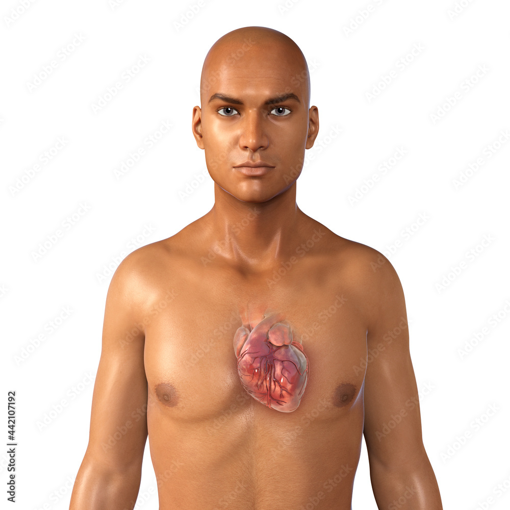 Wall mural human heart anatomy, 3d illustration. concept of heart disease. coronary artery disease, myocardial 