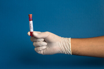 Hand holding a test tube with blood sample for coronavirus or 2019-nCoV analyzing.