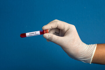 Hand holding a test tube with blood sample for coronavirus or 2019-nCoV analyzing.