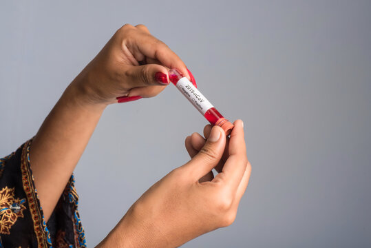 Young girl holding a test tube with blood sample for coronavirus or 2019-nCoV analyzing.