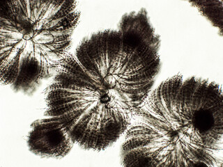Batrachospermum sp. algae under microscopic view, freshwater red algae