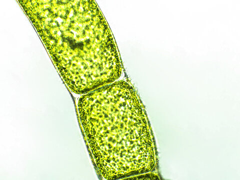 Cladophora sp. algae under microscopic view, green algae