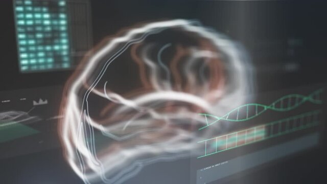 Medical computer screen with tomography of human brain. Diagnosis, examination diseases, modern medicine. Background animation