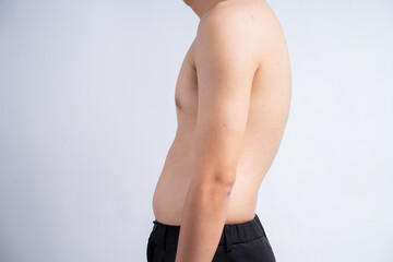 Cropped image of an Asian man with a hunchback