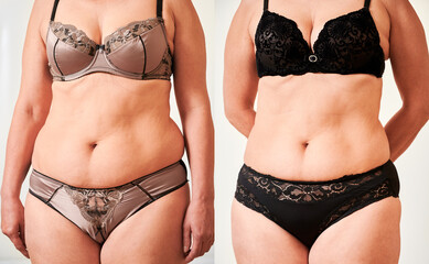 Front view of woman's body before and after weight loss, plastic surgery concept