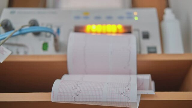 Cardiogram on the device with monitoring of the health of the mother and child during childbirth in the hospital