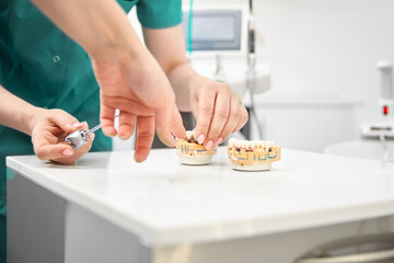 The dentist's hand holds an artificial jaw mock-up and shows the patient's teeth. Treatment in a dental clinic. Close-up.