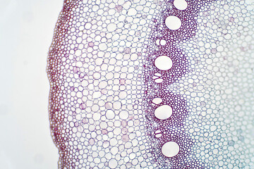 Root plant show root vascular tissue under light microscope view.