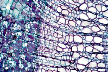 Cross section - Xylem is a type of tissue in vascular plants that transports water and some nutrients.