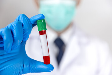 Doctor holding virus blood test tube