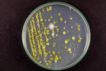 Backgrounds of Characteristics and Different shaped Colony of Bacteria and Mold growing on agar plates from Soil samples for education in Microbiology laboratory.
